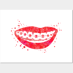 Teeth braces Posters and Art